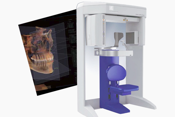 ドイツKaVo社製「3DCT」