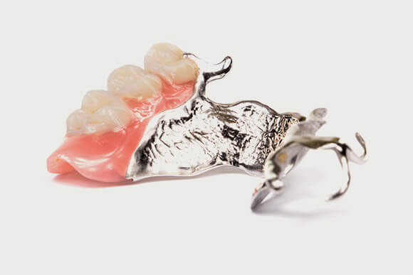 サン歯科クリニックの入れ歯治療